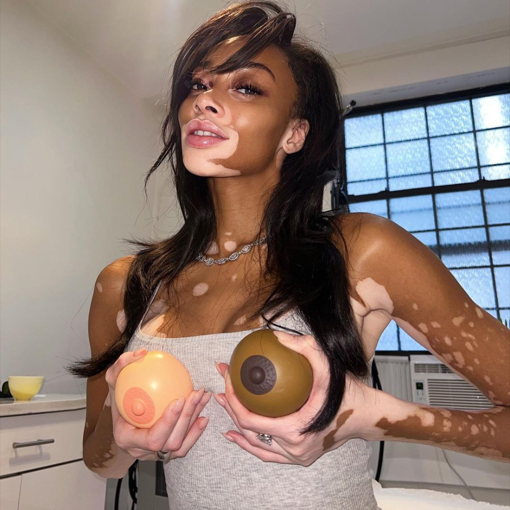 what-is-vampire-breast-lift-style-rave